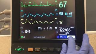 Mindray Passport Patient Monitor Quick Use [upl. by Metzger302]