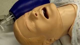 Tracheal intubation direct laryngoscopy [upl. by Anelrac869]