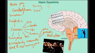 Ataxic dysarthria  samples and explanation [upl. by Shyamal577]