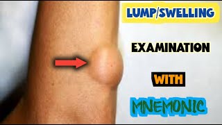 lump examination [upl. by Stryker]