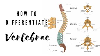 How to differentiate Vertebrae  Viva Voce of Anatomy [upl. by Etteyafal162]