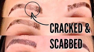 MICROBLADING HEALING PROCESS  THE FIRST 2 WEEKS [upl. by Haimirej]