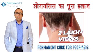 सोरायसिस का पूरा इलाज  Permanent Cure for Psoriasis  Dr Rohit Batra  In Hindi [upl. by Merlin410]