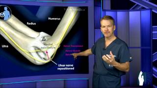 Cubital Tunnel Surgery [upl. by Winsor]