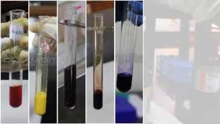 Qualitative Analysis of Amino Acids  Amrita University [upl. by Lawry]