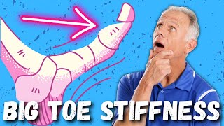 Big Toe PainStiffness Hallux Rigidus 10 Steps to Cure [upl. by Seagraves]