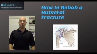 Boxers Fracture  Everything You Need To Know  Dr Nabil Ebraheim [upl. by Andi]