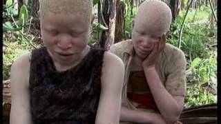 Deadly Hunt Albinos in Tanzania [upl. by Nosrac]